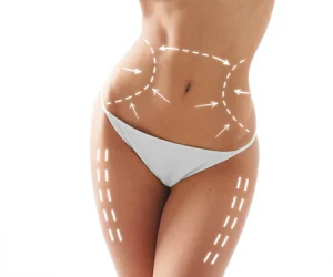 procedura de liposuctie la dl Dr. Panturu