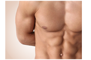 implanturi pectorale la barbati procedura Dr. Panturu