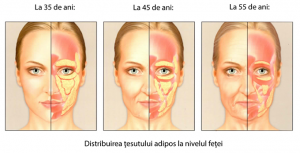 Microlipofilling facial cele 3 stagii Dr. Panturu