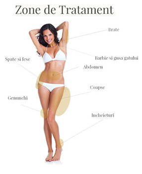 zone tratament liposuctia laser GPS Dr. Panturu