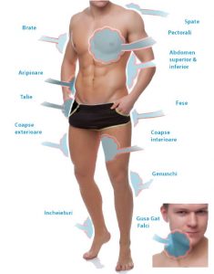 Zone tratament barbati liposuctia laser GPS