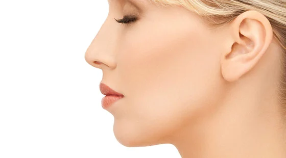 Rinoplastie