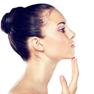 mentoplastie dr radu panturu