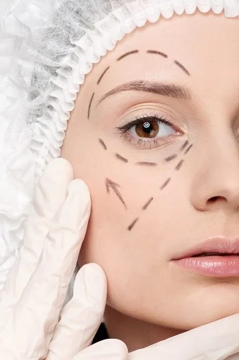 Remodelarea estetică a pleoapelor. Ce presupune blefaroplastia?