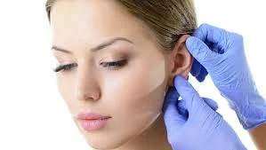 Ce presupune otoplastia, operația care corectează urechile clăpăuge și nu numai