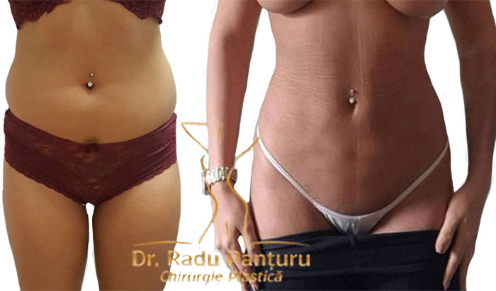 Chirurgie Plastica Estetica Medic Chirurg Estetician Dr Panturu