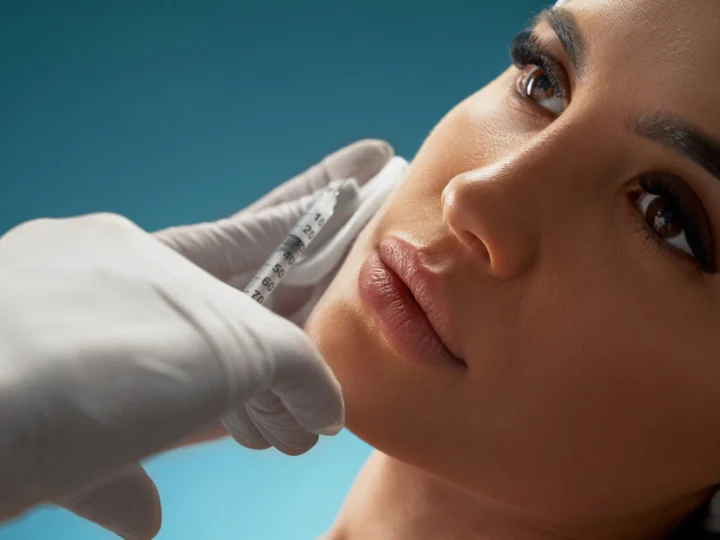 Rinoplastia nonchirurgicală: O alternativă non-invazivă la rinoplastia tradițională