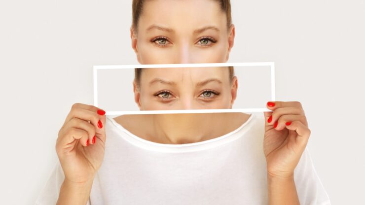 Blefaroplastia &#8211; tratamentul chirurgical pentru pleoape căzute