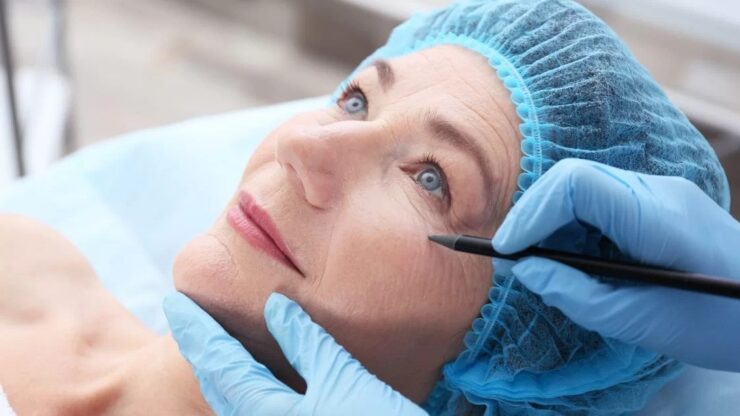 Blefaroplastia &#8211; tratamentul chirurgical pentru pleoape căzute