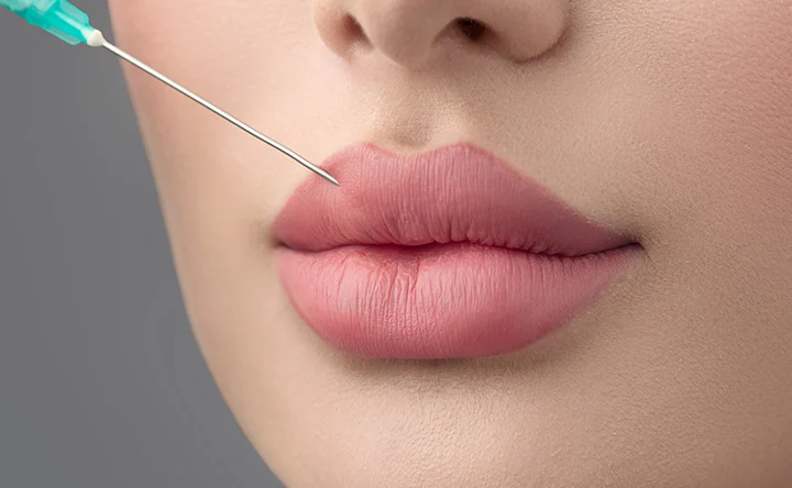 Mărire buze cu acid hialuronic: ce trebuie să știi dacă ești la prima injectare