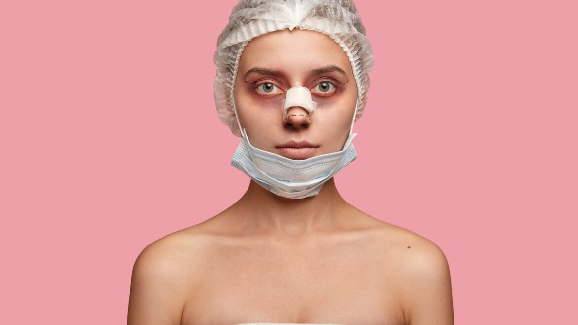 Vânătăi după rinoplastie? Iată cum grăbești procesul de vindecare