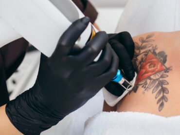 Despre procedura de eliminare a tatuajelor și machiajului semipermanent cu laser