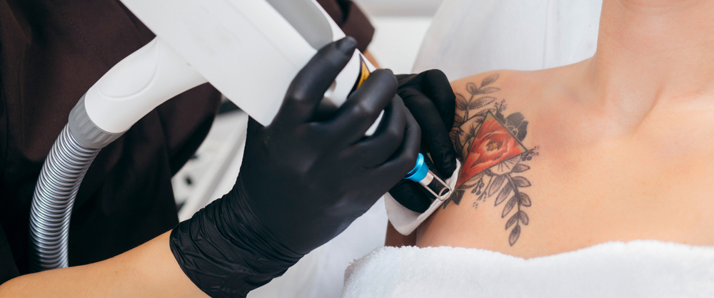 Despre procedura de eliminare a tatuajelor și machiajului semipermanent cu laser