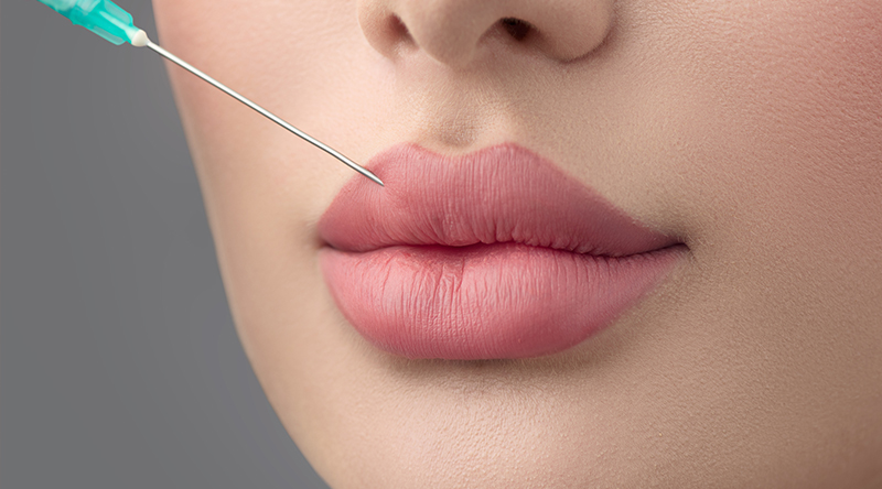 Mărire buze cu acid hialuronic: ce trebuie să știi dacă ești la prima injectare