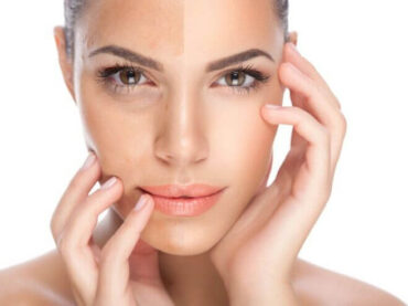 Care sunt efectele și beneficiile terapiei vampir (PRP)?