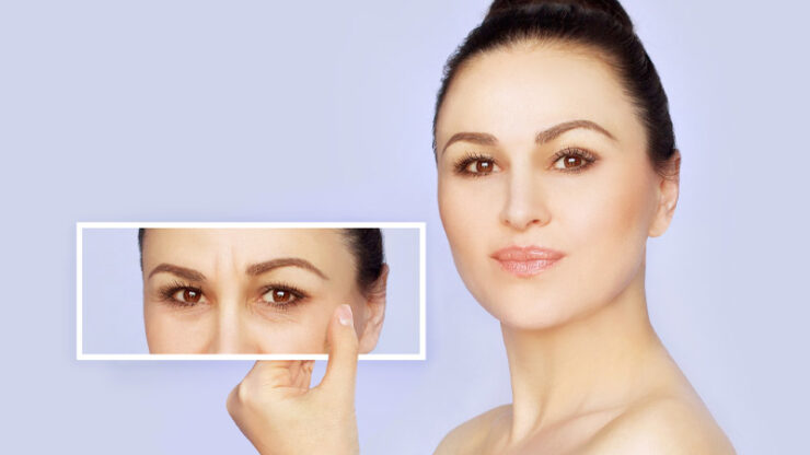 4 Alternative nechirurgicale ale blefaroplastiei chirurgicale