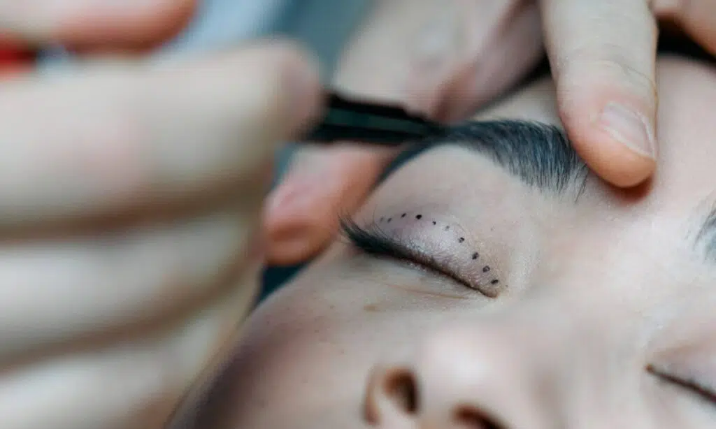 Nevoia de ridicare a pleoapelor: când apare și ce putem face