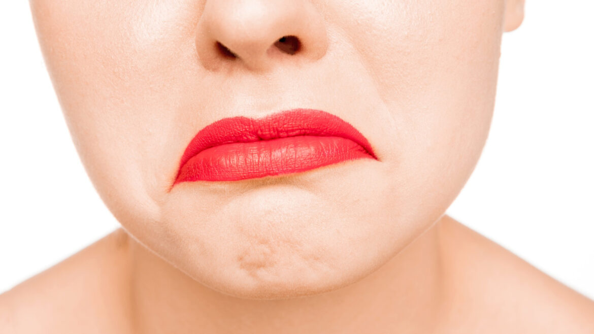 Care sunt cauzele apariției nodulilor după injectarea cu acid hialuronic