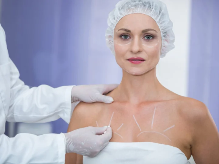 Ce caută tot mai multe paciente înainte de o augmentare mamară modernă